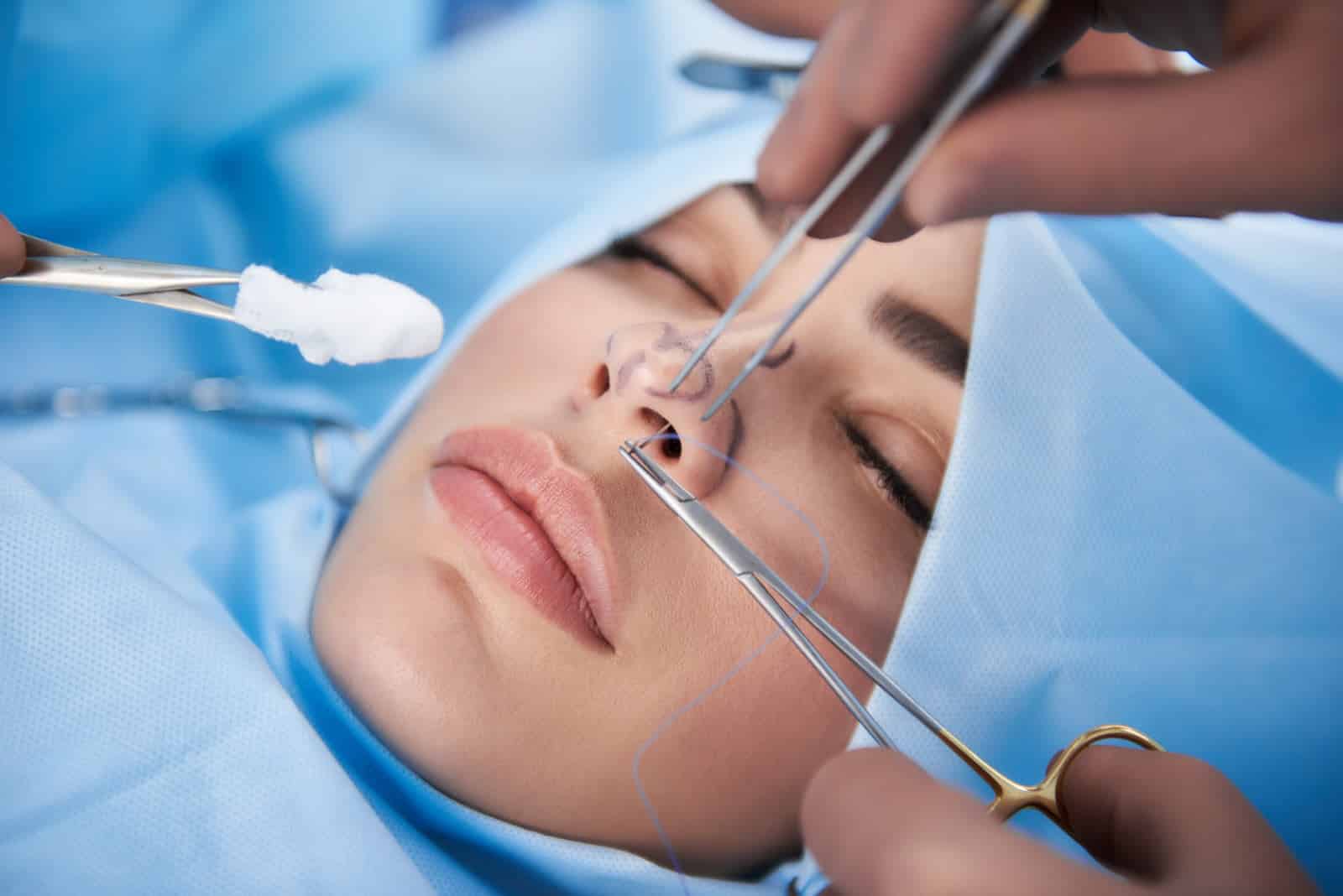 chirurgie esthétique